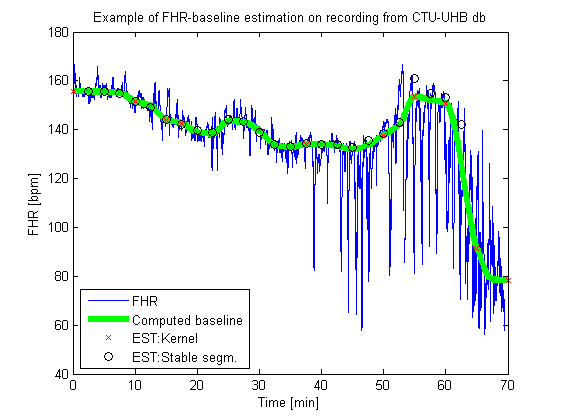 detected baseline of FHR signal